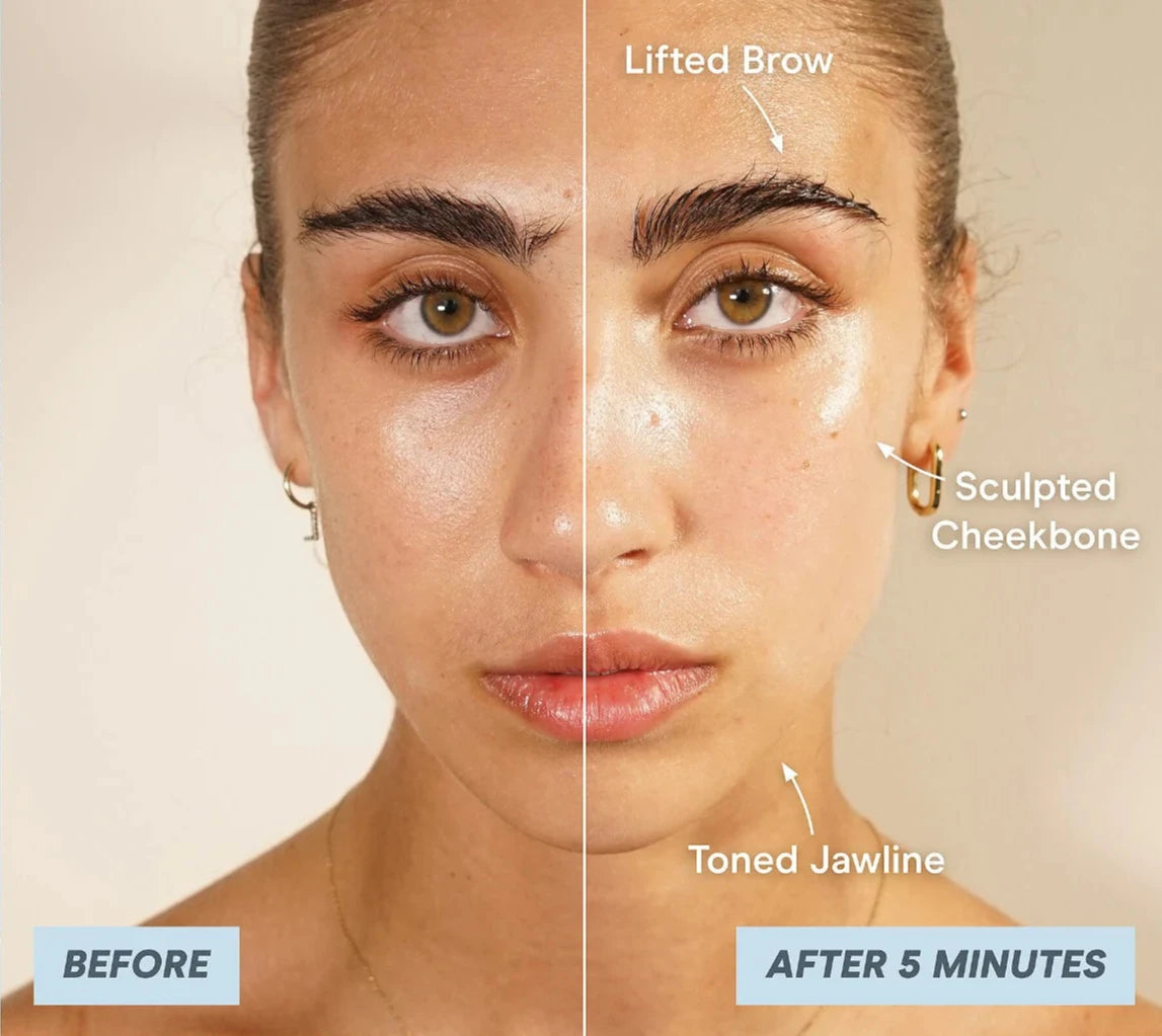 Natural face lift without botox