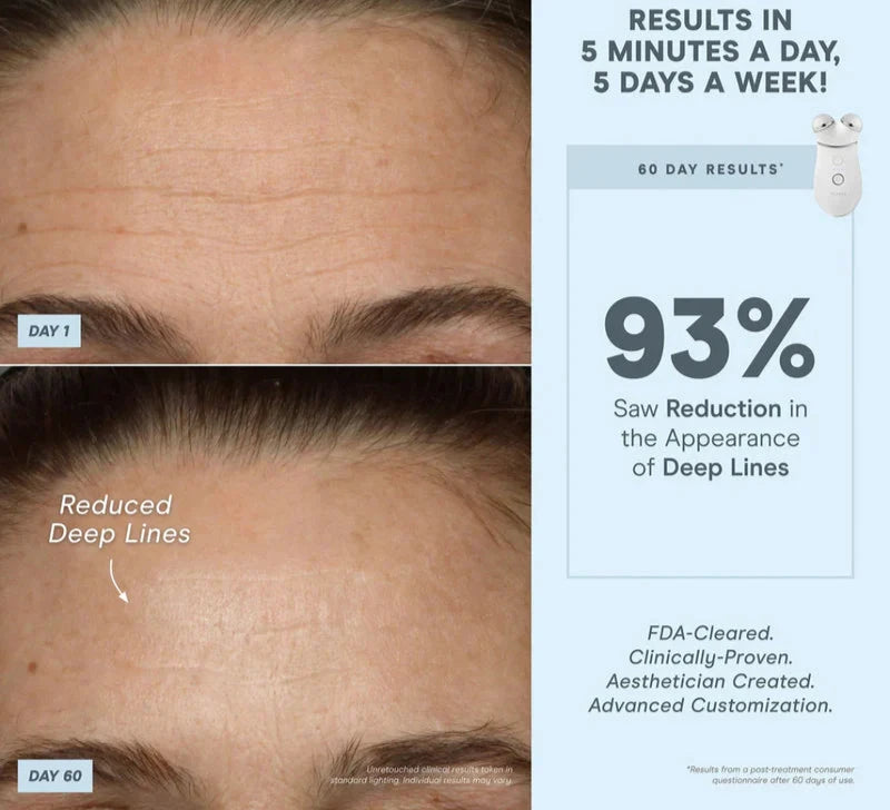 NUFACe, sephora, foreo, omnilux, face lift, natural face lift, mecca maxima