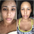 It Girl's LED Face Mask